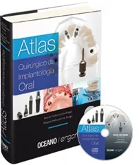 Atlas Quirúrgico de Implantología Oral